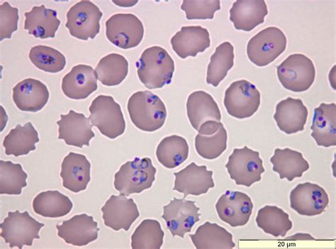  Plasmodium: Ein mikroskopischer Meister der Täuschung - Wie ein unsichtbarer Pirat die roten Blutkörperchen ausplündert!